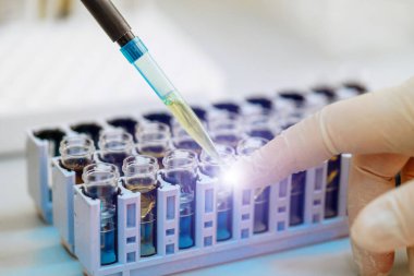 Rack of tube in laboratory with biological material in laboratory at the table. Closeup.