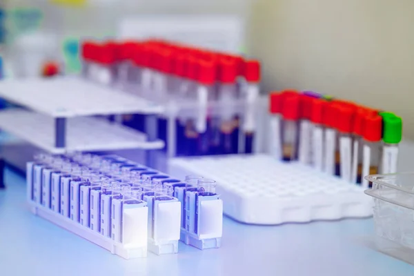 Tubes of blood sample for testing in laboratory. Rack of flasks in laboratory for testing. Biological material, Health care concept. Closeup. — ストック写真