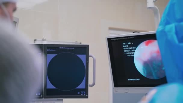 Хирург Смотрит Дисплей Врач Проводит Лапароскопическую Операцию Дроблению Камней Почках — стоковое видео