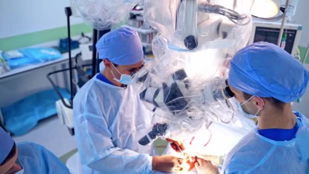 Περίπλοκη Χειρουργική Επέμβαση Μέσω Μικροσκοπίου Ιατρική Ομάδα Μπλε Στολή Εκτελεί — Αρχείο Βίντεο