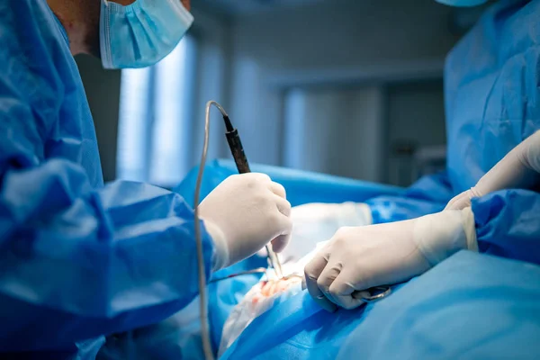 Tıbbi Üniformalı Profesyonel Doktorlar Ameliyat Yapıyor Beyin Cerrahlarının Ameliyat Süreci — Stok fotoğraf