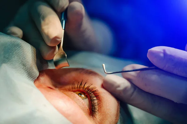 Operation Eye Cataract Surgery Vision Correction — Stock Photo, Image