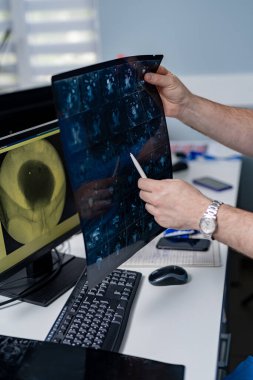 Bilgisayarlı tomografide doktorun elleri. Tıbbi oda arka planı.