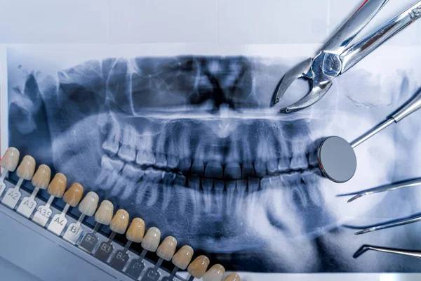 Radiografía Prótesis Dentales Instrumentos Dentales Concepto Estomatología — Foto de Stock