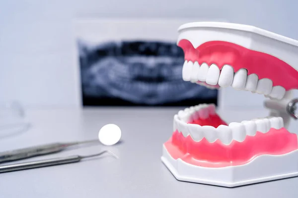 Modelo Dientes Educativos Instrumento Espejo Dentista Rayos Fondo — Foto de Stock