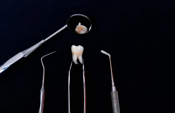 Instrumentos Dentales Alrededor Del Modelo Dientes Cerámica Fondo Negro Foto — Foto de Stock