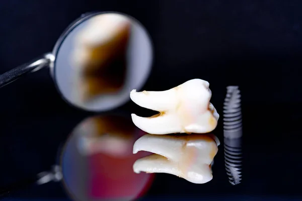 Zahnimplantat Modell Auf Schwarzem Hintergrund Und Zahnspiegel — Stockfoto