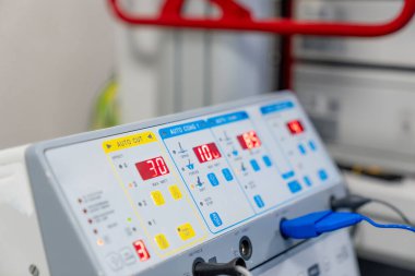 Tıbbi ekipman temiz veri gösteriyor. Dijital ekran, devam eden tıbbi izleme sürecini gösteren hayati değerleri ve ayarları gösterir..