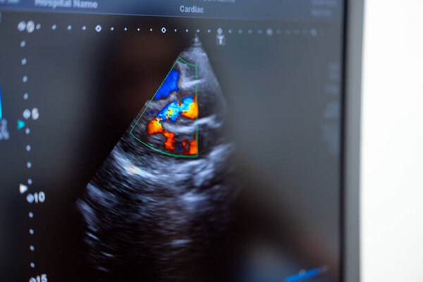 Сонограмма показывает сердцебиение плода. Подробная УЗИ показывает сердцебиение плода во время планового обследования в медицинском учреждении, фиксируя жизненно важные признаки.