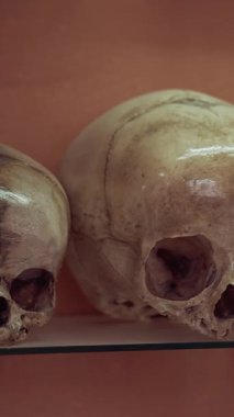 Müzedeki antik insan kafatası. Çiğ kafatasları tıp müzesinde insan evrimini gösteriyor.