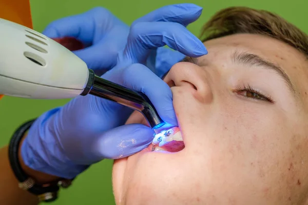 Parantez genç çocuğun dişlerde bağlama doktorlar eller — Stok fotoğraf