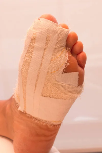 Close Persons Bandaged Broken Big Toe — Stock Photo, Image