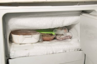 Buzdolabının çözülmesi gerekiyor.