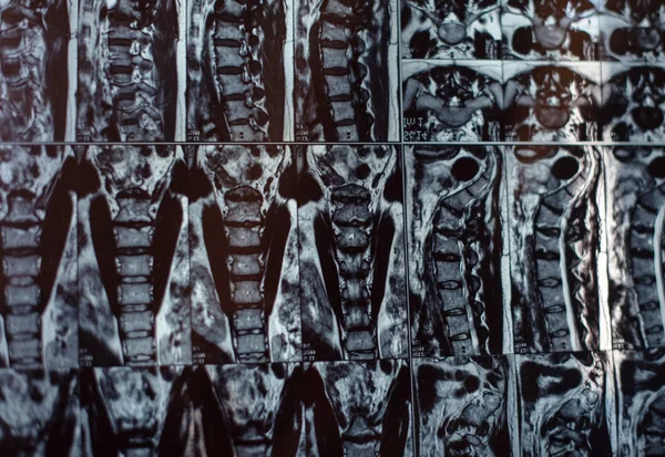 xray image of human spine