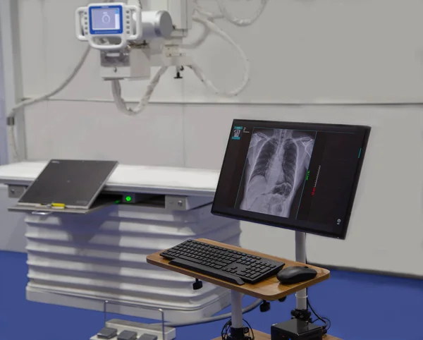 병원에서 엑스레이 방 — 스톡 사진