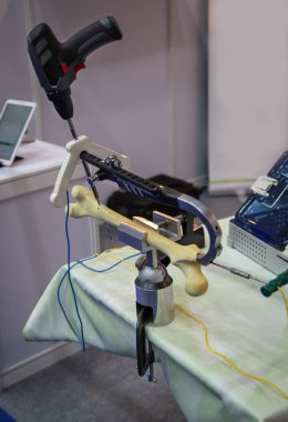 Ortopedik travma aygıtları