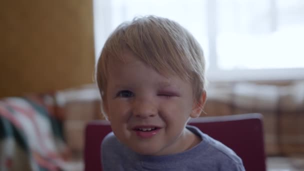 Rodičovství, malé smutné dítě s extravazací a modřinami v očích dítěte v nebezpečných situacích — Stock video