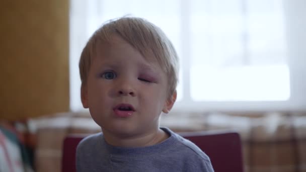 Portrait of sorrowful little boy cannot open his eyes from an injury or a bruise on his face half-dangled during dangerous activities for children — Stock Video