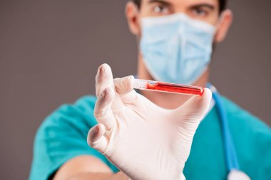 Hastane laboratuarında Covid-19 test tüpü.