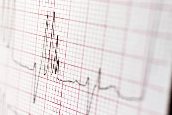 Cardiogram — Stock Photo, Image