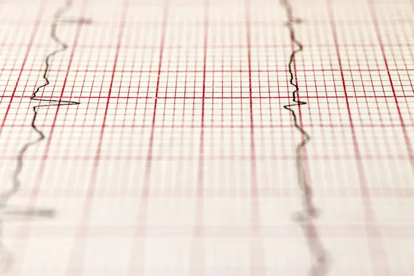 Cardiogram — Stock Photo, Image