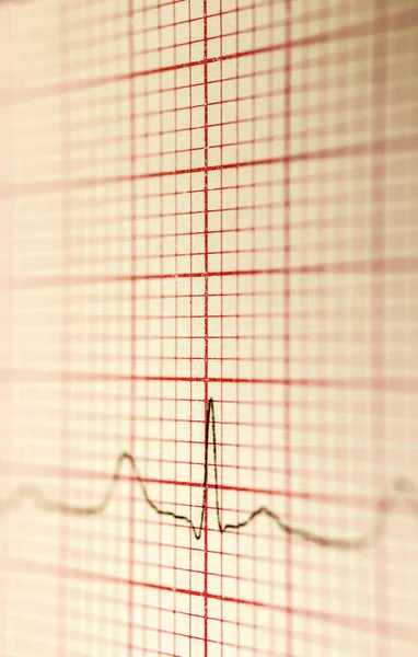 Cardiogram — Stockfoto