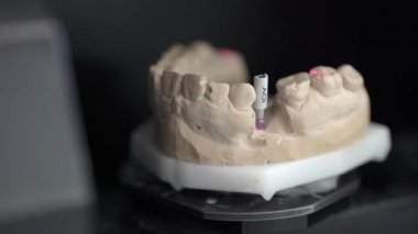 Diş 3d tarayıcı tarama işleminde yakın çekim görünümü