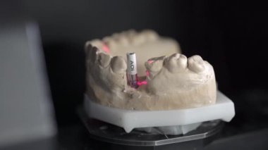 Diş 3d tarayıcı tarama işleminde yakın çekim görünümü