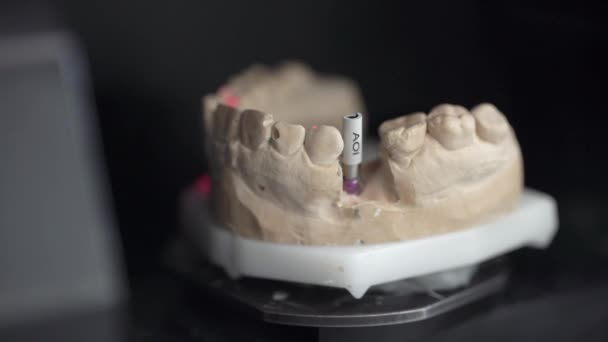 Close-upweergave tijdens scanproces in tandheelkundige 3D-scanner — Stockvideo