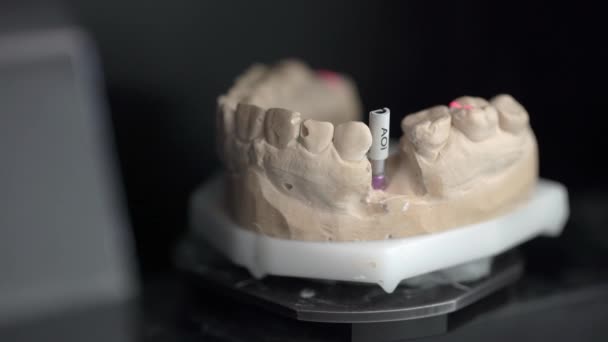 Просмотр крупным планом процесса сканирования в стоматологическом 3D сканере — стоковое видео