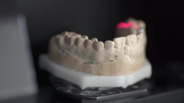 Θέα στο κοντινό πλάνο στη διαδικασία σάρωσης στο Οδοντιατρικό σαρωτή 3D — Αρχείο Βίντεο