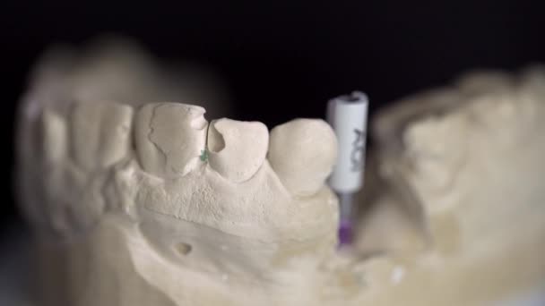 Просмотр крупным планом процесса сканирования в стоматологическом 3D сканере — стоковое видео