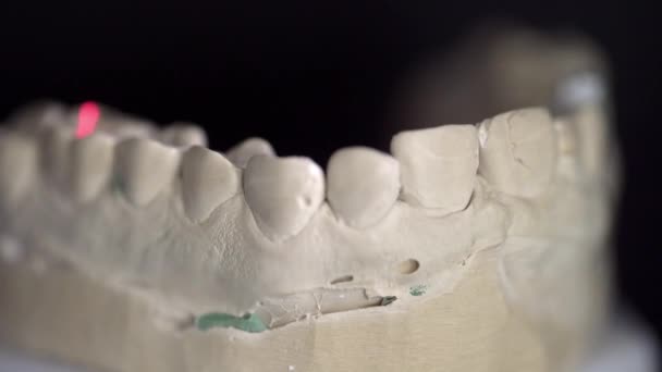 Tampilan close up pada proses pemindaian dalam pemindai 3D gigi — Stok Video