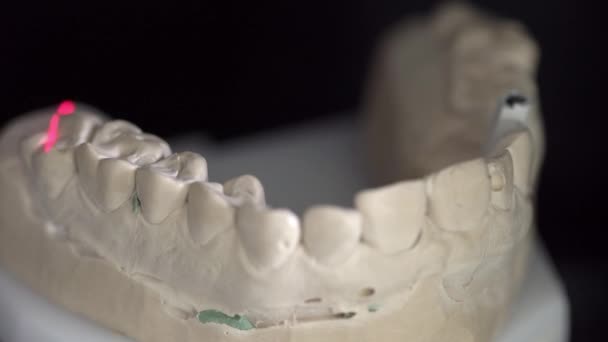 दंत 3D स्कॅनर मध्ये स्कॅनिंग प्रक्रियेवर बंद दृश्य — स्टॉक व्हिडिओ