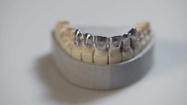 Close-upweergave bij tandheelkundige kaak model in laboratorium — Stockvideo