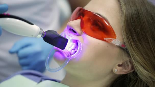 Красивые женские зубы отбеливаются в стоматологической клинике — стоковое видео