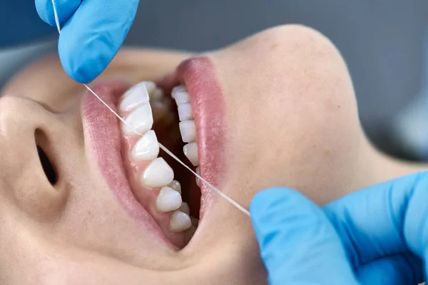 Mooie Womans tanden reiniging in de tandheelkundige kliniek — Stockfoto