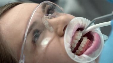 Diş kliniğinde Pretty WOMANS diş temizliği