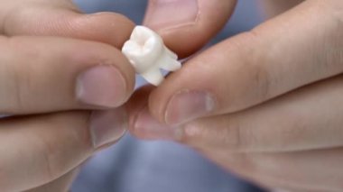 Erkek ellerde beyaz molar diş çekim görünümü
