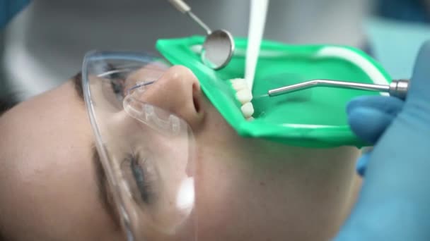 Pěkná ženská úprava zubů na zubní klinice — Stock video