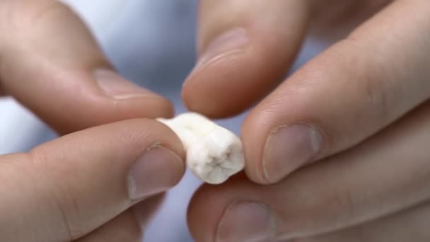 Primo piano vista a dente molare bianco in mani maschili — Video Stock