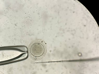 İn vitro fertilizasyon sürecinde mikroskop üzerinden görünüm