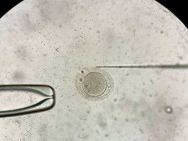 İn vitro fertilizasyon sürecinde mikroskop üzerinden görünüm