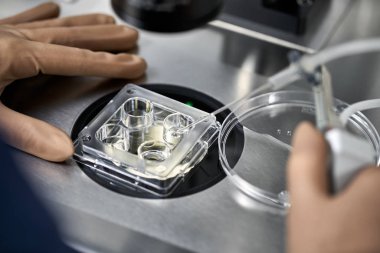 Process of in vitro fertilization in laboratory clipart