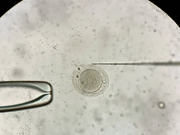 Vue au microscope lors du processus de fécondation in vitro — Photo
