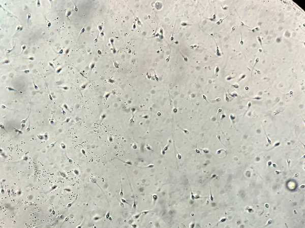 Vista allo sperma umano al microscopio in laboratorio — Foto Stock