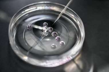 Laboratuvarda in vitro fertilizasyon süreci