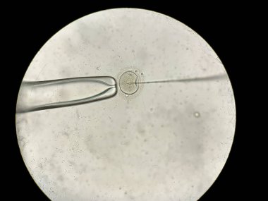 İn vitro fertilizasyon sürecinde mikroskop üzerinden görünüm