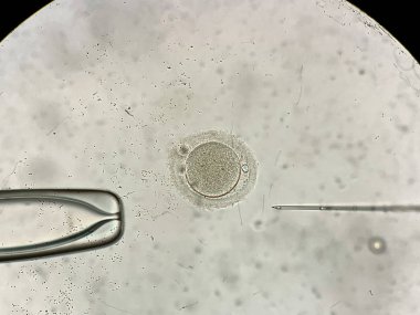 View through microscope at in vitro fertilization process clipart