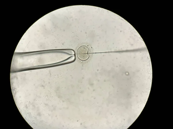 Vista attraverso il microscopio al processo di fecondazione in vitro — Foto Stock